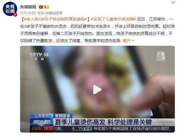 警惕！错误处理致 3 岁童烫伤感染加剧，儿童烧烫伤科学应对全攻略